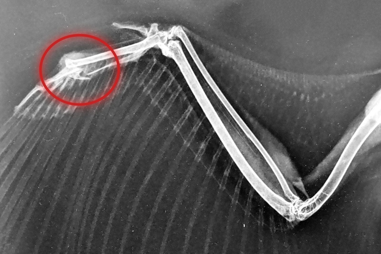 xray of NHO's fractured wing